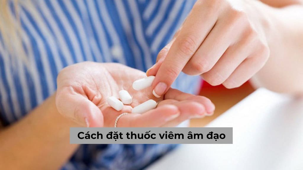 Chuyên gia hướng dẫn về cách đặt thuốc viêm âm đạo