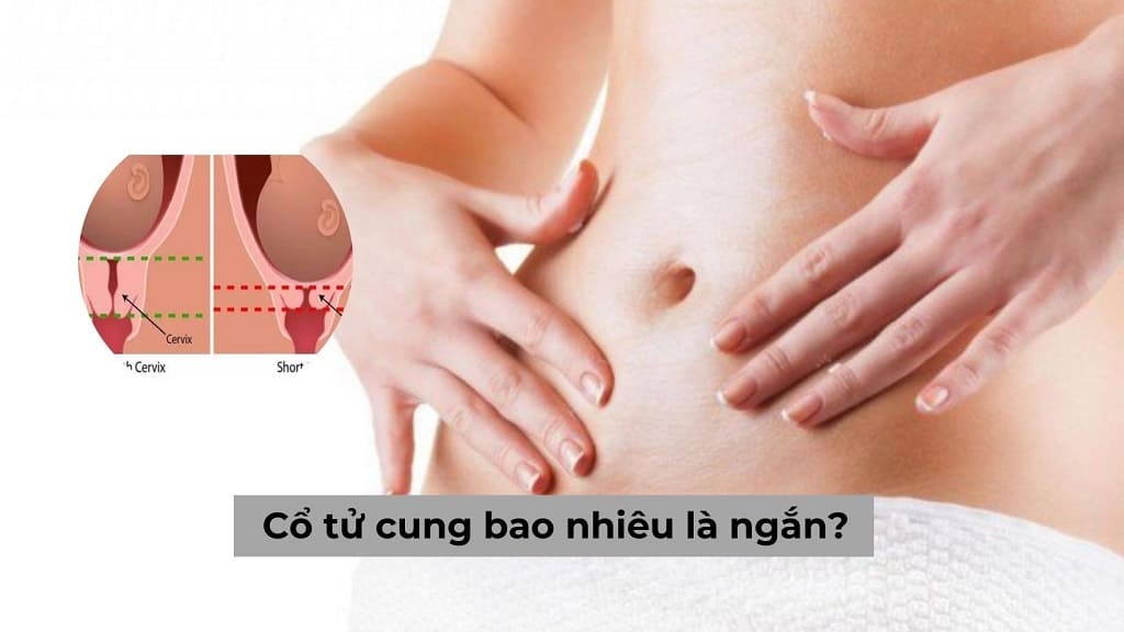 Cổ tử cung bao nhiêu là ngắn? Gây ra ảnh hưởng gì?