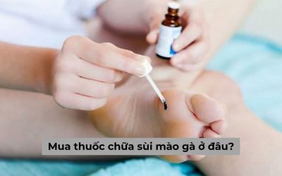 [Góc thắc mắc] Mua thuốc chữa sùi mào gà ở đâu an toàn?