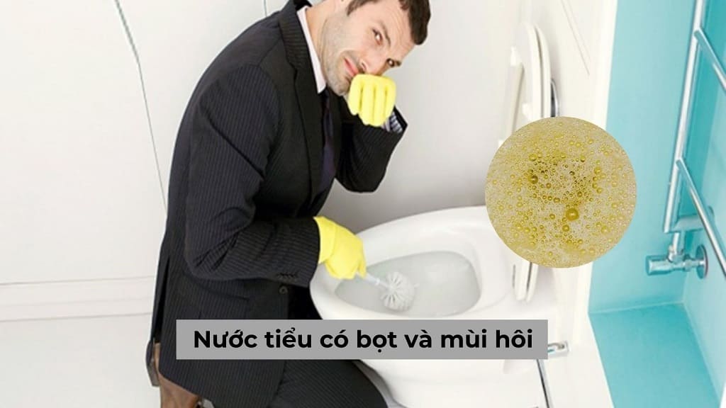 Nước tiểu có bọt và mùi hôi chớ có được coi thường!