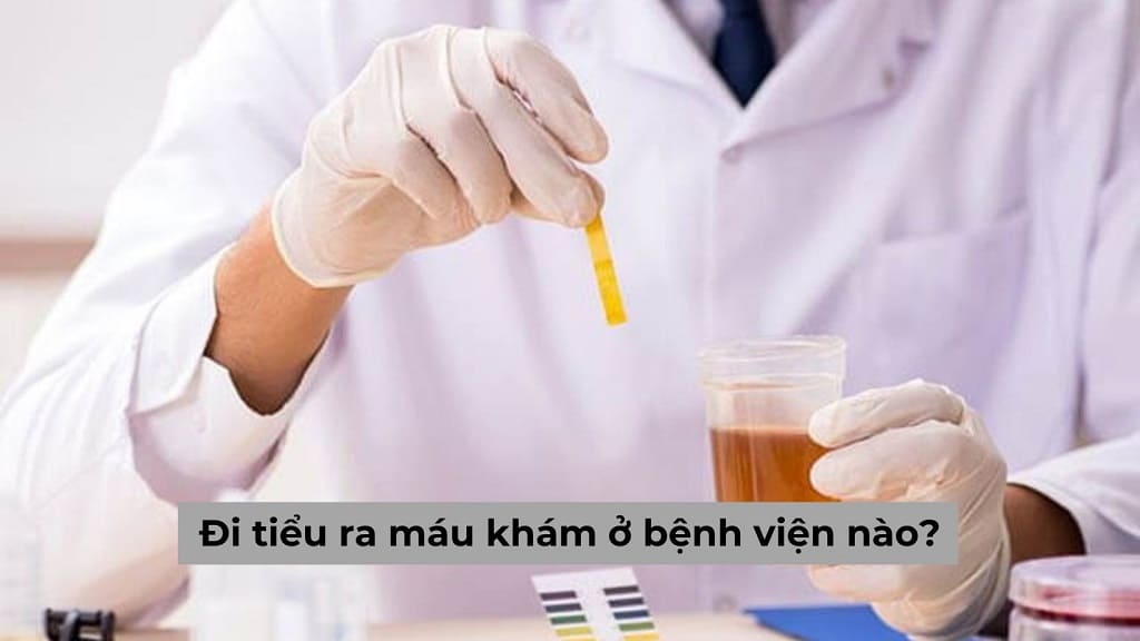 Chuyên gia gợi ý cho người đi tiểu ra máu khám ở bệnh viện nào?