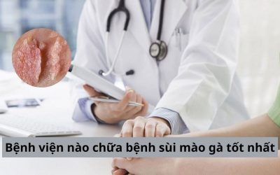 Bệnh viện nào chữa bệnh sùi mào gà tốt nhất ở Hà Nội? [Review]