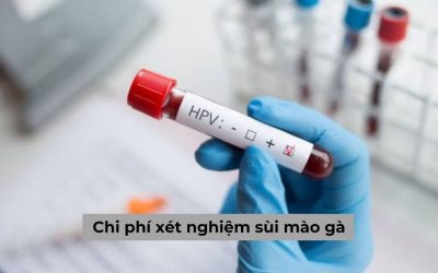 Chi phí xét nghiệm sùi mào gà bao nhiêu tiền? [Bảng giá mới]