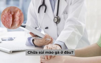 [Hot] Top 5 địa chỉ chữa sùi mào gà ở đâu uy tín năm 2024?