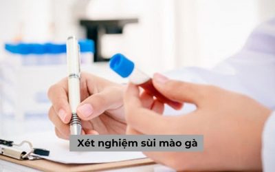 [Tổng hợp] Xét nghiệm sùi mào gà và những điều cần biết