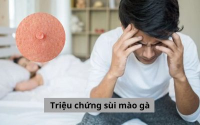 Điểm mặt các triệu chứng sùi mào gà không phải ai cũng biết