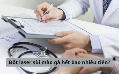 Đốt laser sùi mào gà hết bao nhiêu tiền? [Bảng giá mới nhất]