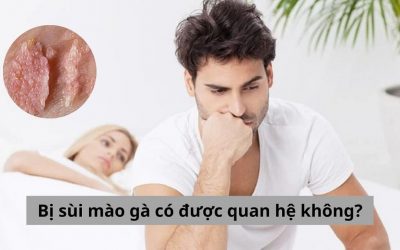 Bị sùi mào gà có được quan hệ không? Chuyên gia giải đáp