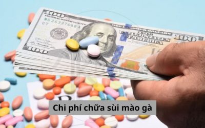 Những điểm cần lưu tâm về chi phí chữa sùi mào gà