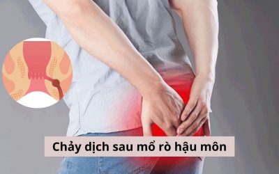 (Giải đáp thắc mắc) Chảy dịch sau mổ rò hậu môn có sao không?
