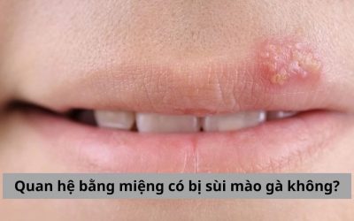[Góc giải đáp] Quan hệ bằng miệng có bị sùi mào gà không?