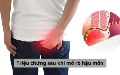 Đâu là các triệu chứng sau khi mổ rò hậu môn người bệnh cần lưu tâm?