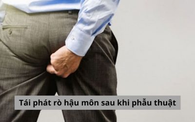 Nguyên nhân tái phát rò hậu môn sau phẫu thuật và cách khắc phục