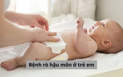 Bệnh rò hậu môn ở trẻ em và những điều bố mẹ cần biết
