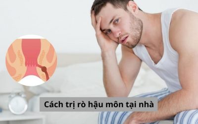 Có cách trị rò hậu môn tại nhà không? Đâu là giải pháp tốt nhất?