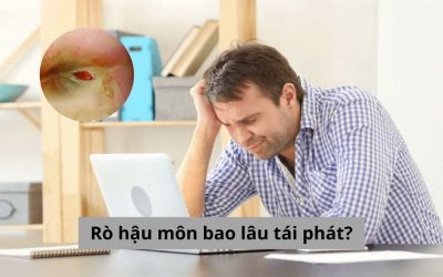 Rò hậu môn bao lâu tái phát? Nguyên nhân và cách phòng ngừa?
