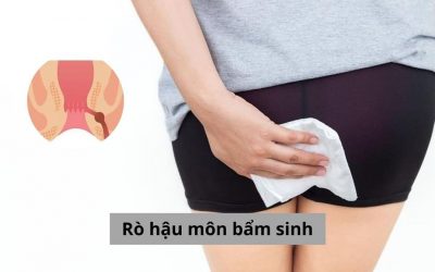 Cha mẹ cần biết những gì về căn bệnh rò hậu môn bẩm sinh