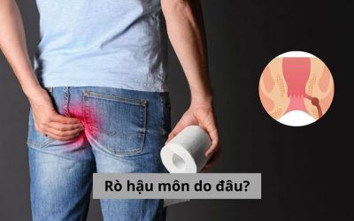 Giải đáp thắc mắc: Rò hậu môn do đâu? 5 nguyên nhân thường gặp