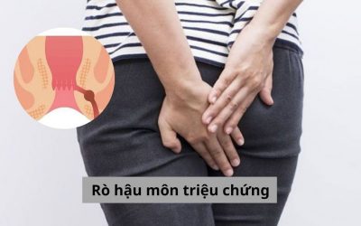 Bệnh rò hậu môn triệu chứng thế nào, làm sao để phát hiện và điều trị?