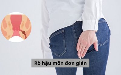 Tất tần tật về rò hậu môn đơn giản người bệnh cần biết