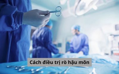 Chuyên gia chia sẻ về cách điều trị rò hậu môn hiệu quả tối ưu hiện nay