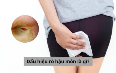 Dấu hiệu rò hậu môn là gì? Liệu bệnh có chữa được không?