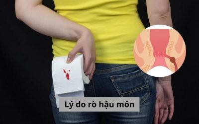 Lý do rò hậu môn là gì? Tìm chi tiết nguyên nhân gây bệnh