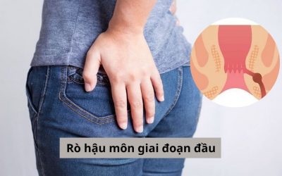 Rò hậu môn giai đoạn đầu có nguy hiểm không? Phương pháp điều trị