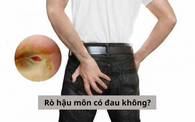Điều trị rò hậu môn có đau không? – Nên điều trị rò hậu môn ở đâu?