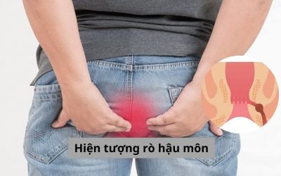 Bạn cần biết những gì về hiện tượng rò hậu môn? 