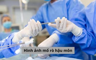 Hình ảnh mổ rò hậu môn chi tiết chân thực [Tổng hợp]