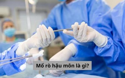 Mổ rò hậu môn là gì? Liệu nên thực hiện ở đâu cho an toàn?