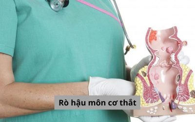 Rò hậu môn cơ thắt là gì? Bệnh có gây nguy hiểm không?