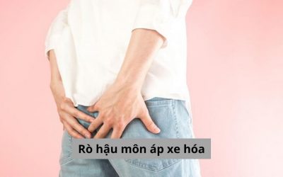 Một số vấn đề bạn cần biết về rò hậu môn áp xe hoá