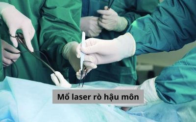 Mổ laser rò hậu môn là gì? Có nên mổ laser không?