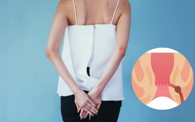 [Hỏi – Đáp] Rò hậu môn là thế nào? Bệnh lý này có thể chữa khỏi không?