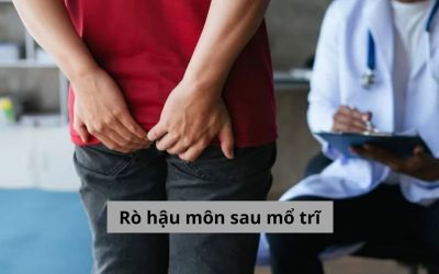 Cảnh báo nguy hiểm: Biến chứng rò hậu môn sau mổ trĩ 