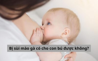 Vấn đề nan giải: Bị sùi mào gà có cho con bú được không?