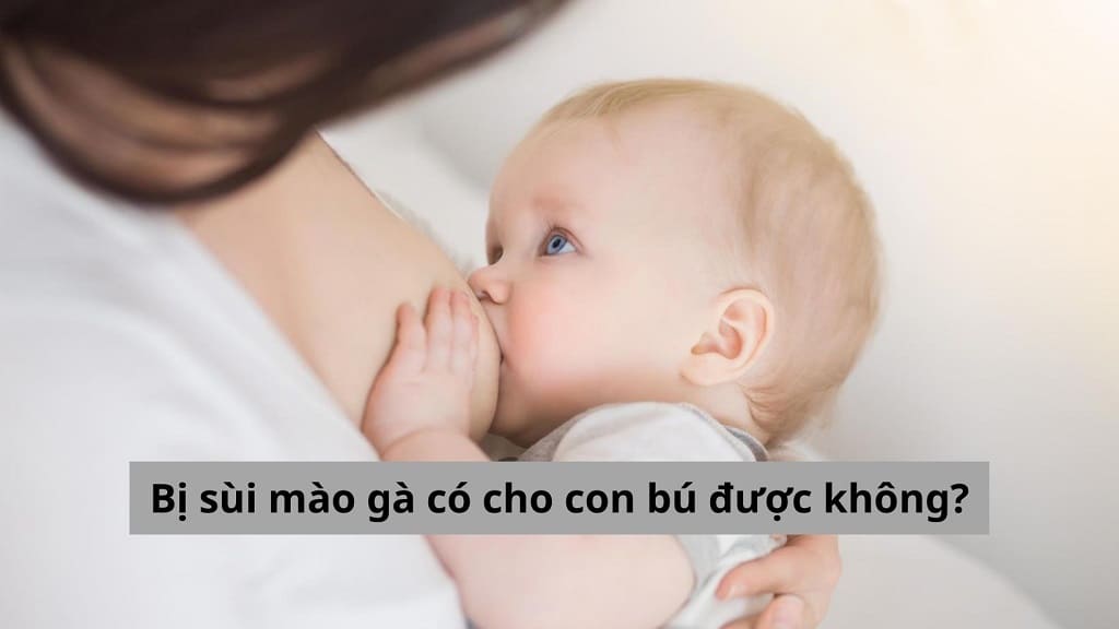 Vấn đề nan giải: Bị sùi mào gà có cho con bú được không?