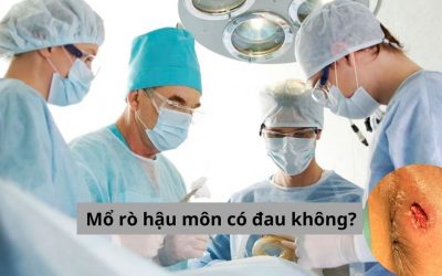 [Hỏi – Đáp] Mổ rò hậu môn có đau không? Bao lâu thì lành?