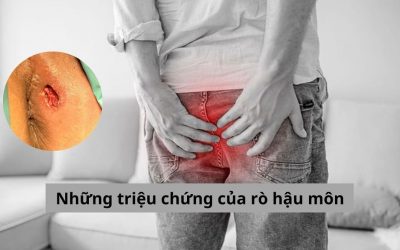 Tìm hiểu những triệu chứng của rò hậu môn và biến chứng khôn lường