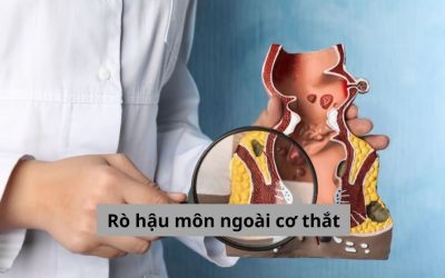 Rò hậu môn ngoài cơ thắt và những thông tin bạn không nên bỏ lỡ