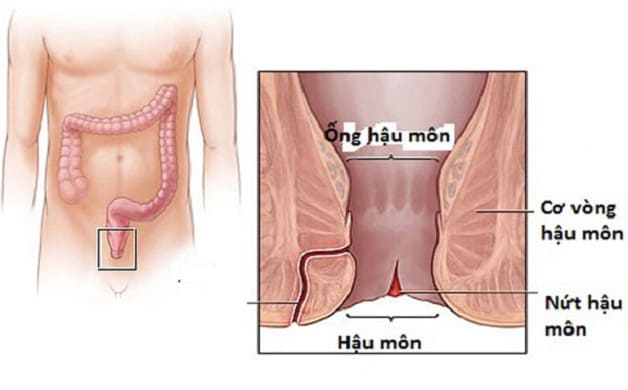 Mổ rò hậu môn là gì?