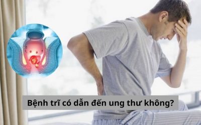 Tìm lời giải đáp cho câu hỏi bệnh trĩ có dẫn đến ung thư không?