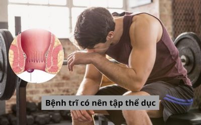Liệu mắc bệnh trĩ có nên tập thể dục? Lời khuyên từ chuyên gia