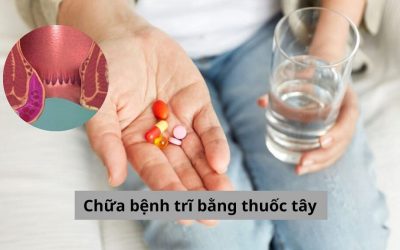 Giải đáp thắc mắc: Chữa bệnh trĩ bằng thuốc tây có thật sự an toàn?