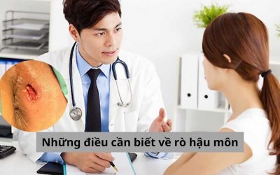 Những điều cần biết về rò hậu môn để chữa khỏi bệnh sớm