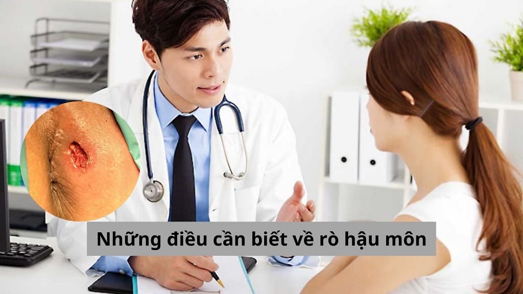 Những điều cần biết về rò hậu môn để chữa khỏi bệnh sớm