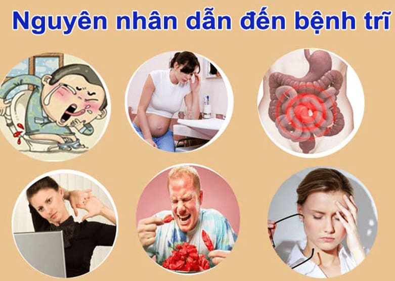 Nguyên nhân gây bệnh trĩ