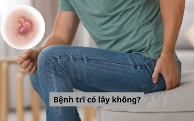 [Giải đáp] Bệnh trĩ có lây không, nếu lây thì lây qua con đường nào?